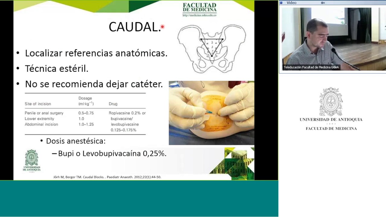 Técnias neuroaxiales en pediatria