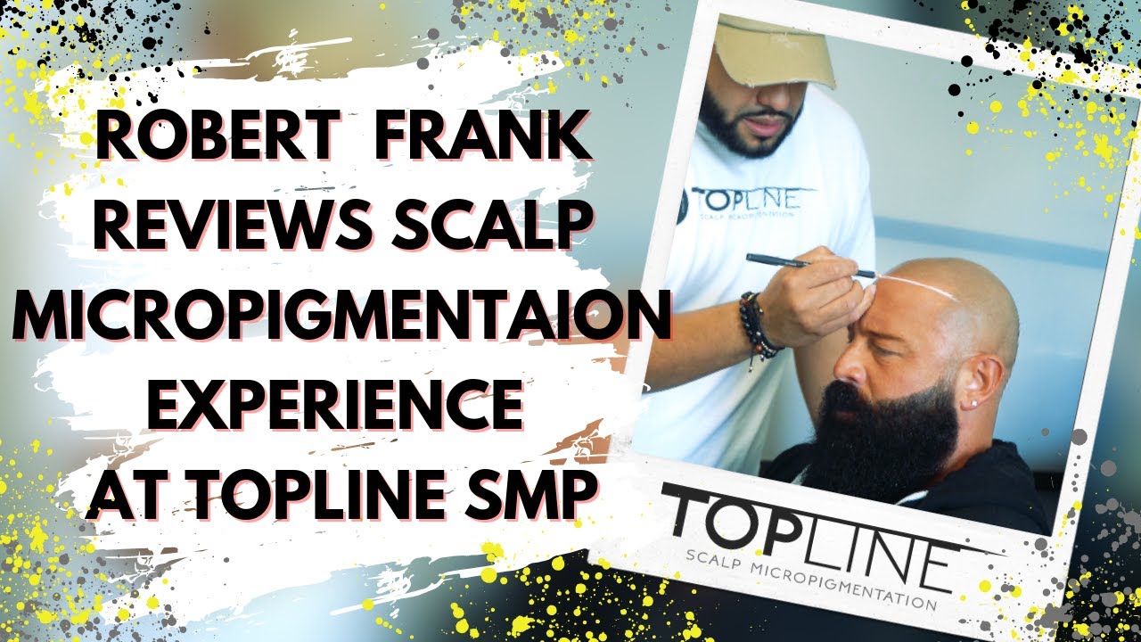 @robertfrank615 #scalpmicropigmentation Testimonial | TOPLINESMP