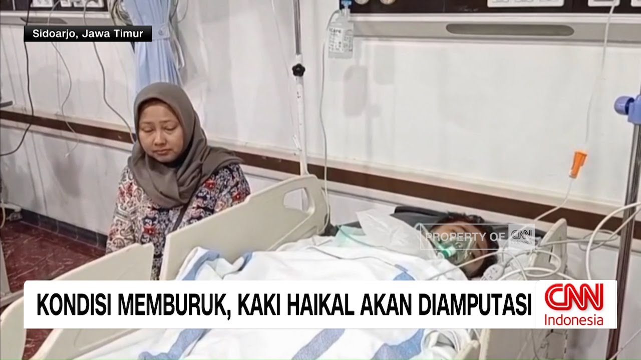 Kondisi Memburuk, Kaki Haikal Korban Ponpes Roboh Akan Diamputasi