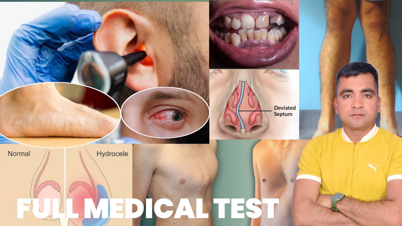 Full Medical Test Indian Army😨 आँख कान नाक मुँह हाथ पैर चेस्ट इत्यादि Army Medical Test✅ - JD Sir