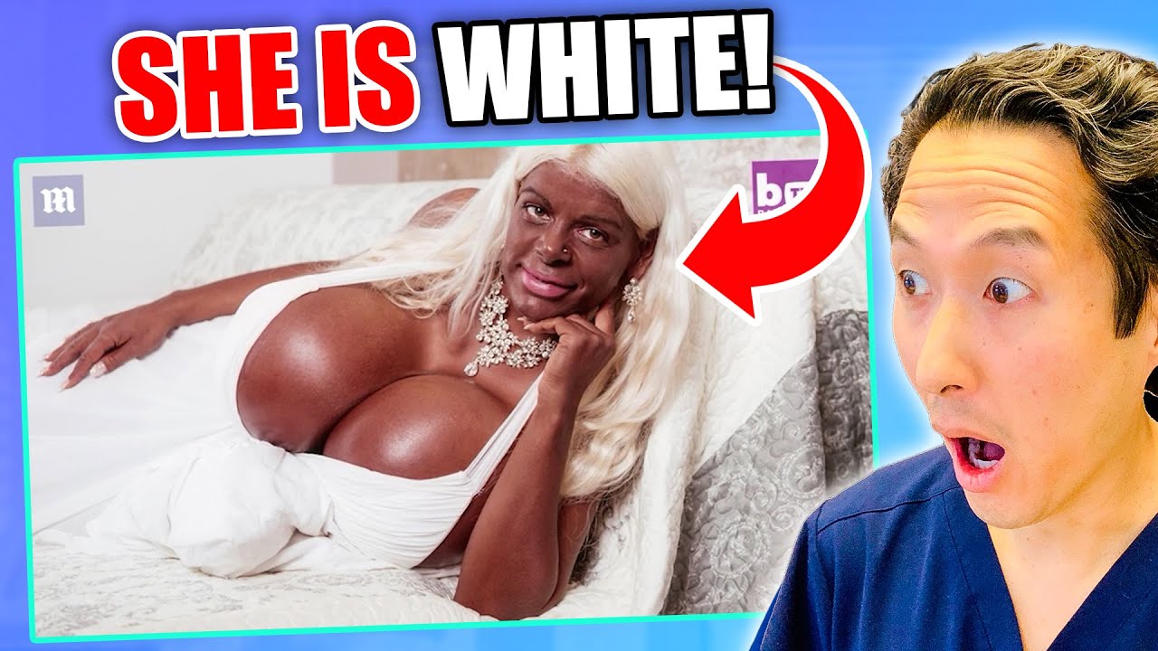 Woman Went From White to Dark Skin! EXTREME Bodies EXPLAINED!