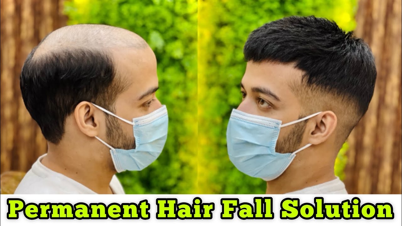 Undetectable Short hair patch look! by anas sheikh in delhi! call us 9650914665