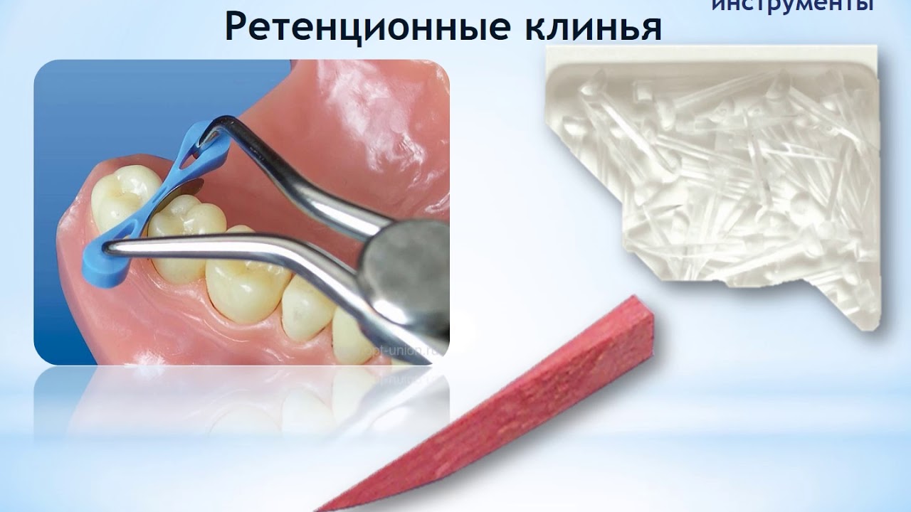 Подготовка и пломбирование кариозных полостей: инструменты, материалы, алгоритм