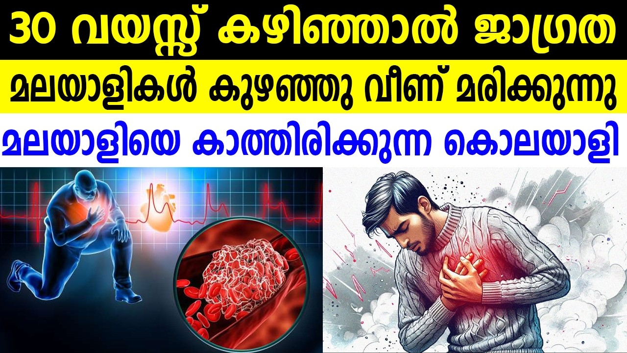 30 വയസ്സ് കഴിഞ്ഞാൽ ജാഗ്രതമലയാളികൾ കുഴഞ്ഞു വീണ് മരിക്കുന്നു മലയാളിയെ കാത്തിരിക്കുന്ന കൊലയാളി