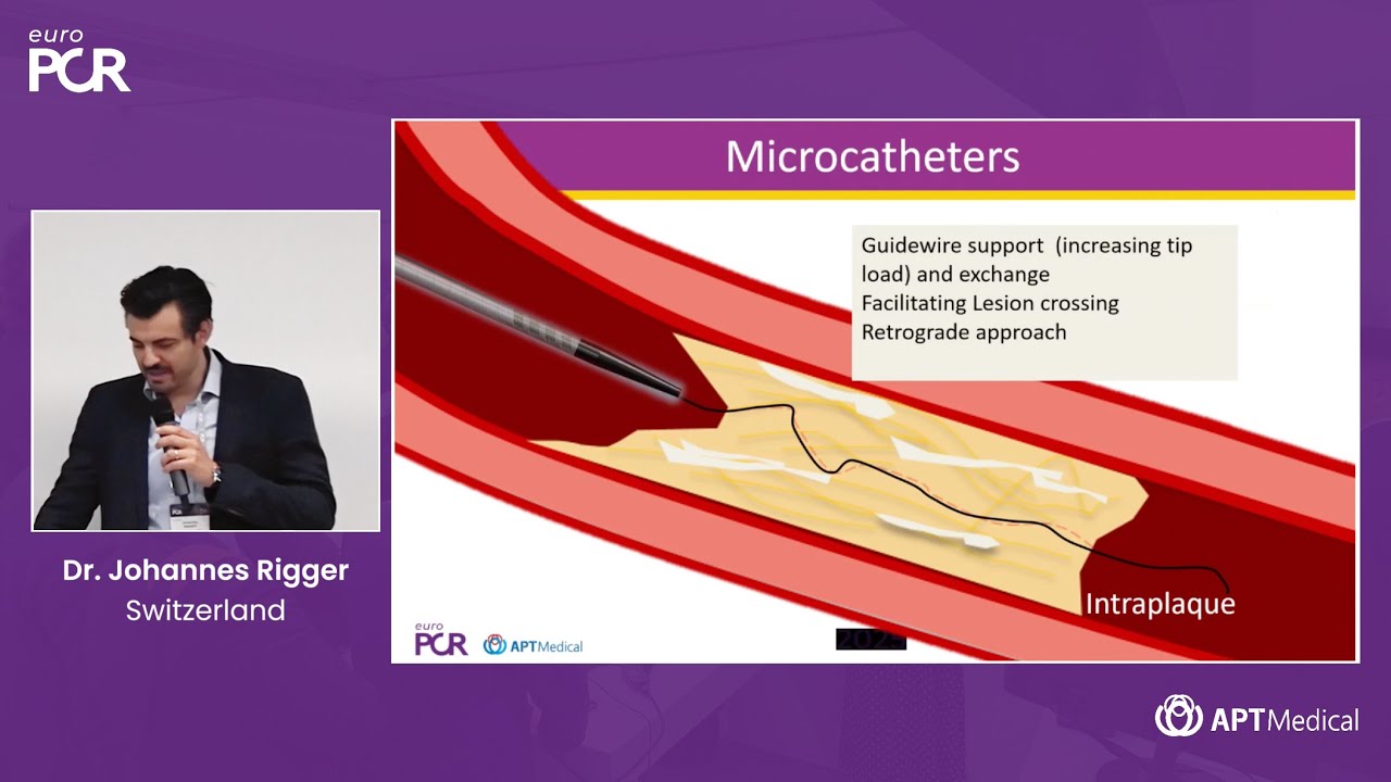 Managing Tortuous Anatomies - Dr. Johannes Rigger (Switzerland) | EuroPCR 2025