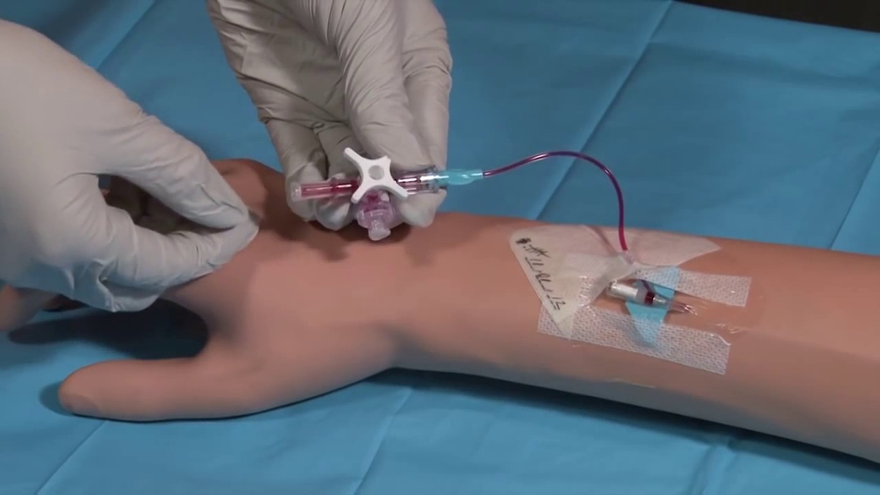 Becton Dickinson Nexiva IV System Review