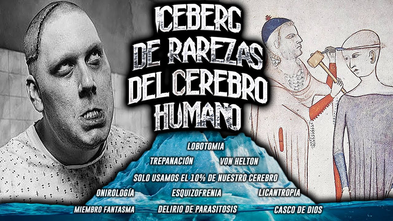 EL ICEBERG DE LAS RAREZAS DEL CEREBRO HUMANO