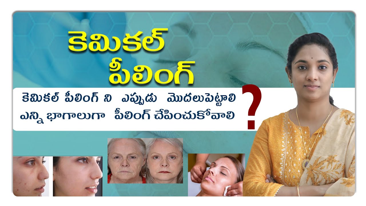 కెమికల్ పీలింగ్ ని ఎప్పుడు మొదలుపెట్టాలి |ఎన్ని భాగాలుగా పీలింగ్ చేపించుకోవాలి Dr.Kavya Chennamsetty