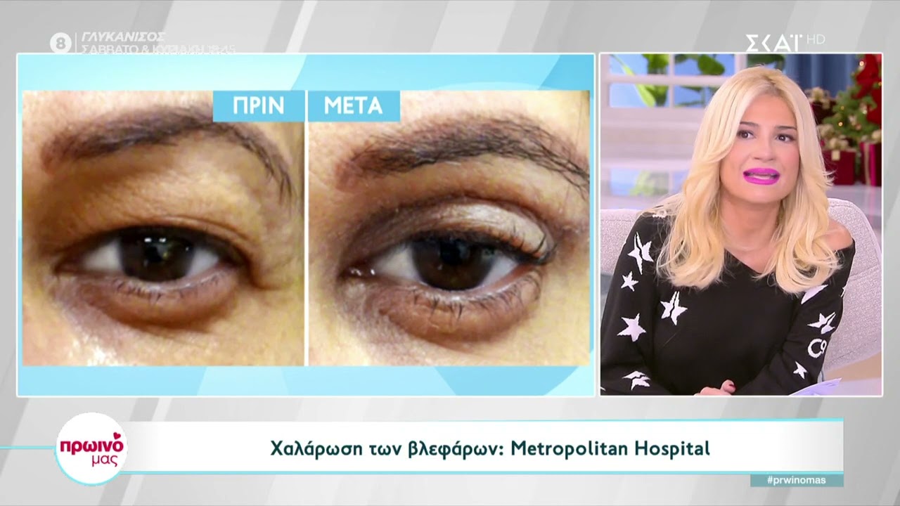Γεώργιος Παπαγεωργίου | Βλεφαροπλαστική