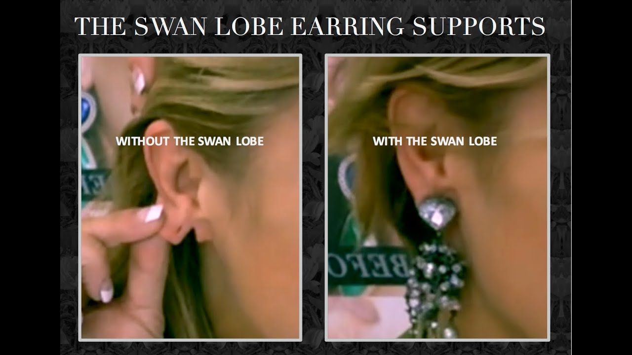 Repairing a torn earlobe without surgery