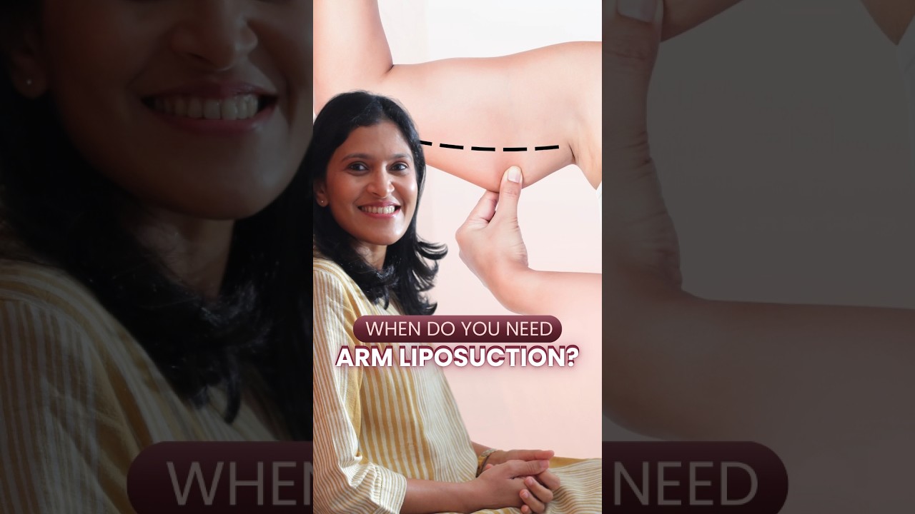 When do you need ARM LIPOSUCTION? Top Plastic Surgeon Reveals ARM LIPOSUCTION Secrets #shorts