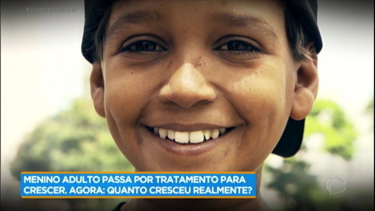 “Menino adulto” cresce 24 centímetros após tratamento