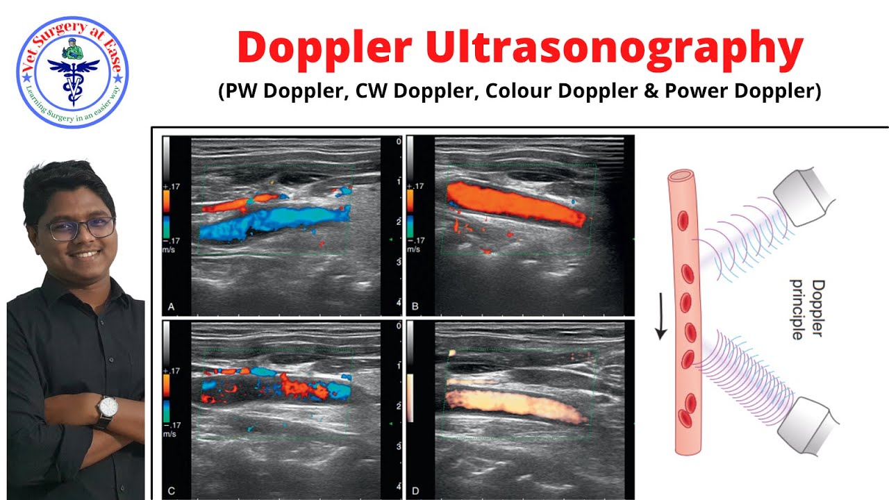 Doppler (Type, Controls & Artifacts) | Lecture 03 | Ultrasonography