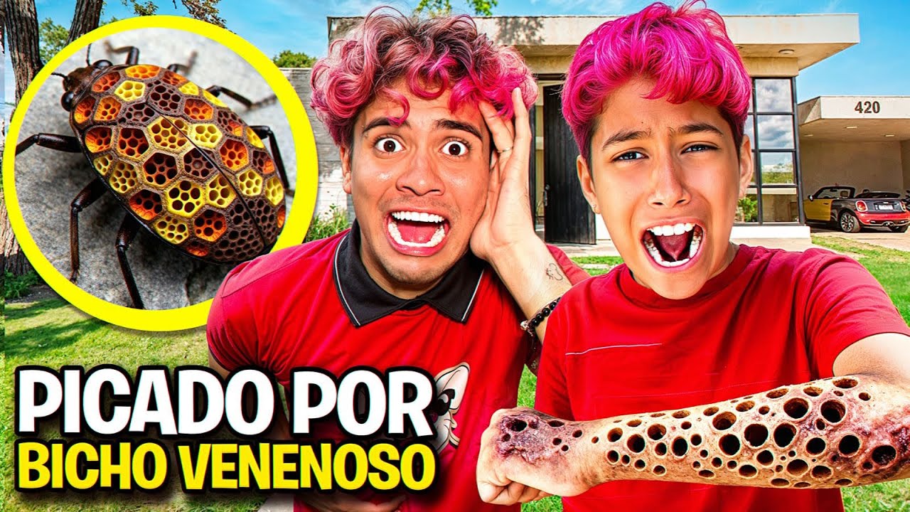 FUI PICADO POR UM BICHO ESTRANHO VENENOSO 🤮