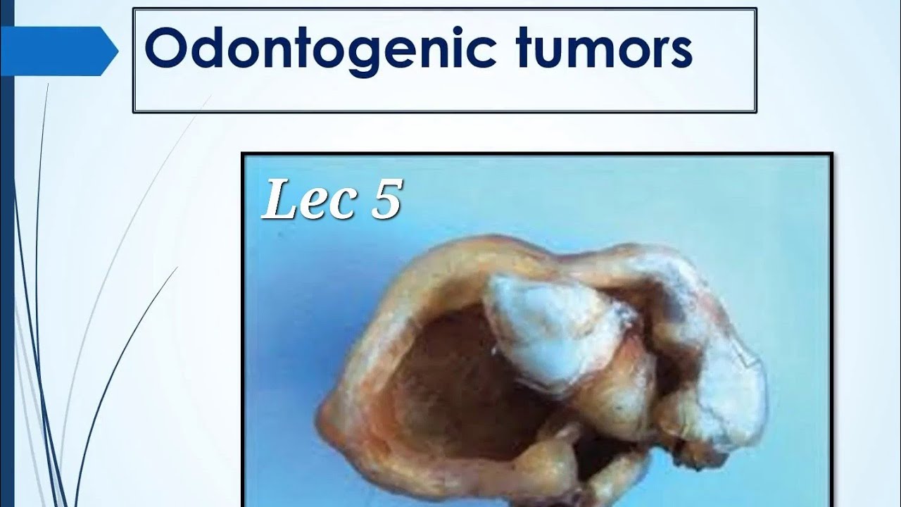 Oral Pathology 1 ; Lec 5 ; Odontogenic Tumors