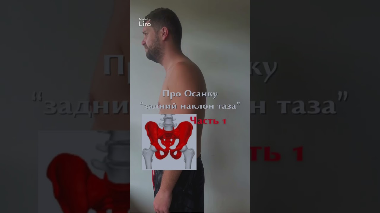 Задний наклон таза 