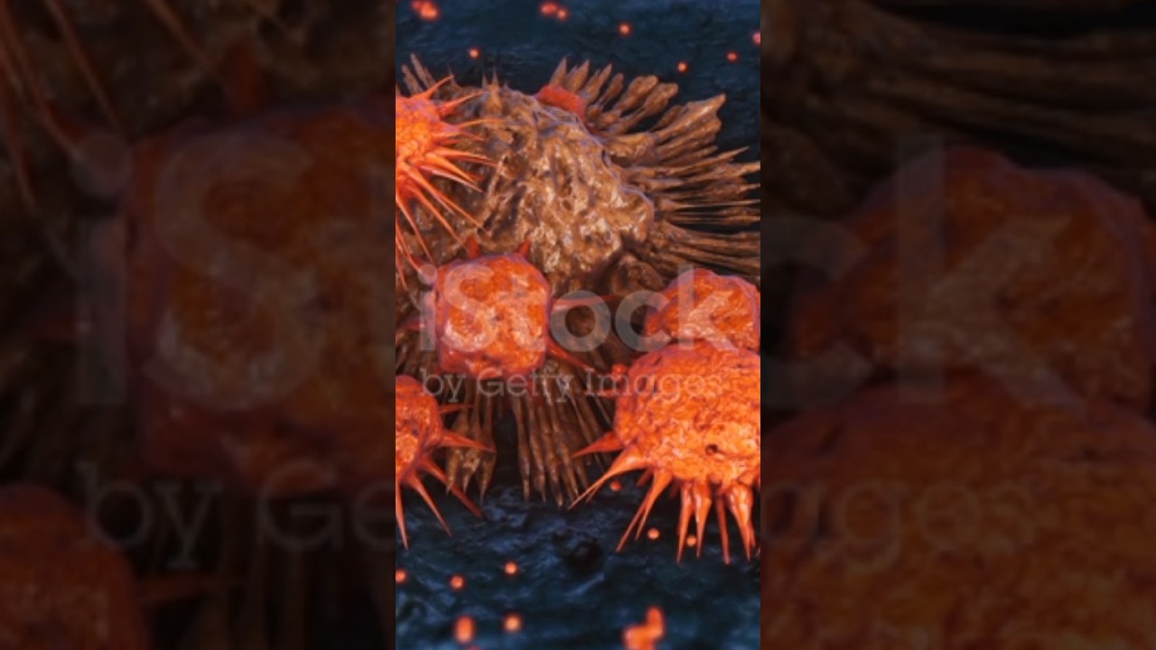 blood cancer| blood cancer causes| blood cancer treatment| leukemia| 