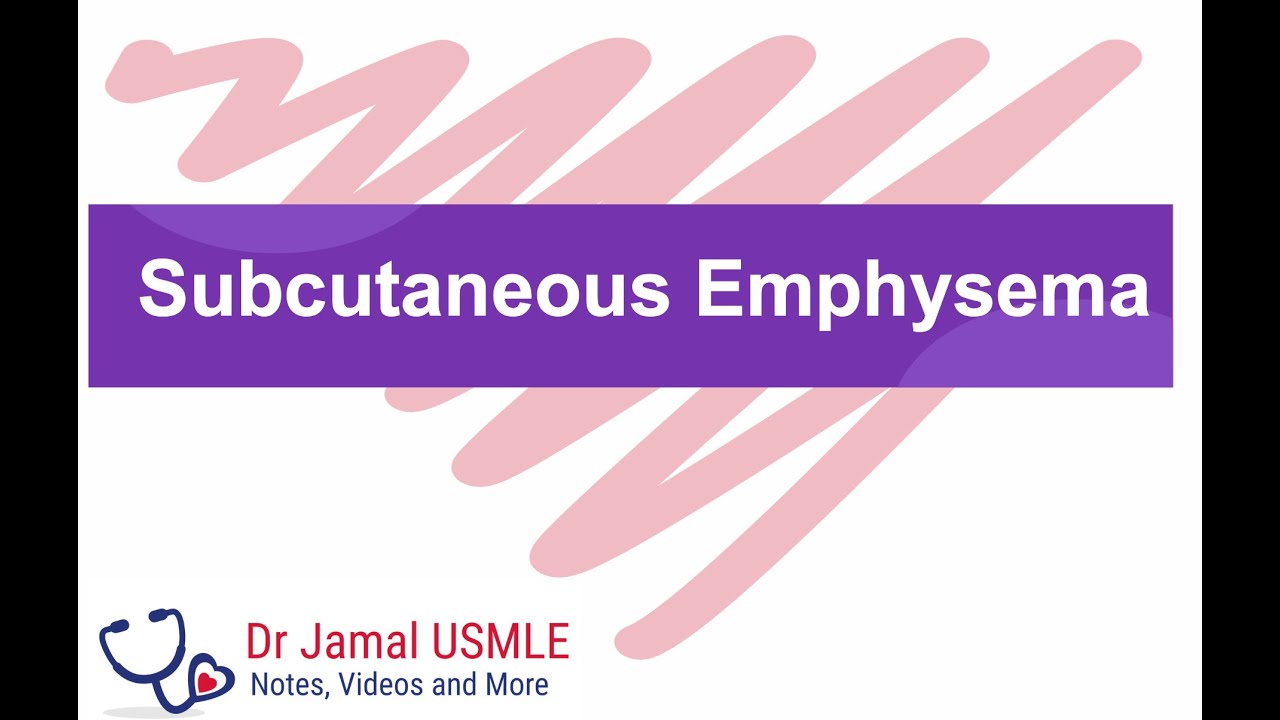 Subcutaneous Emphysema! Can you feel the bubbles? by Dr Jamal USMLE