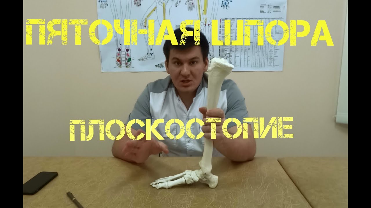 Как стопа влияет на все мышцы и позвоночник. Пяточная шпора, плоскостопие.