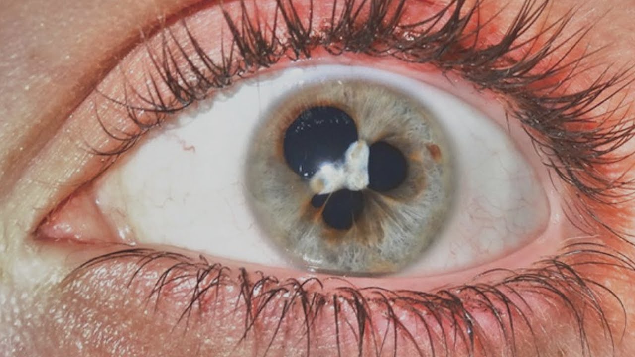 LA EVOLUCION DEL OJO