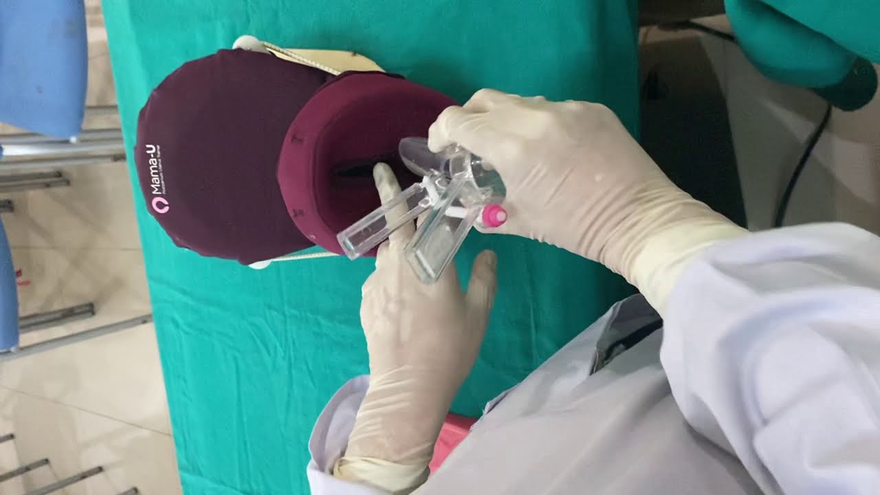PPIUCD insertion vid | Dr. Shahlla Kanwal |