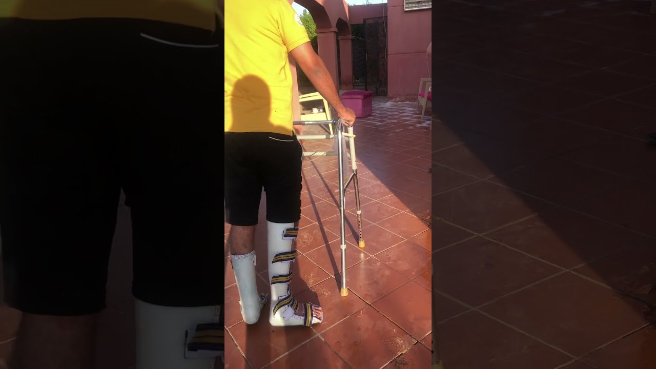 علاج اصابه نخاع شوكي و شلل نصفي يمشي مفرده مع العلاج الطبيعي المكثف مع د. رانيا السيد01006875199
