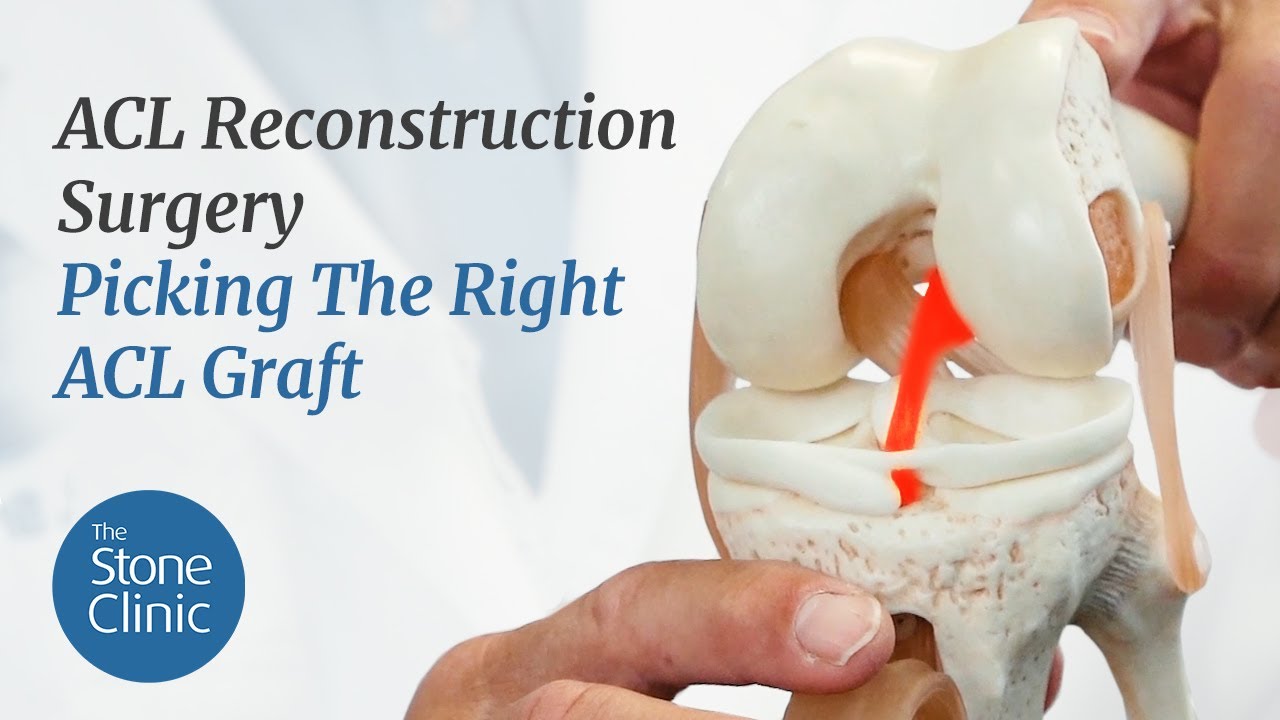 ACL Reconstruction Surgery Explained  & Picking The Right ACL Graft