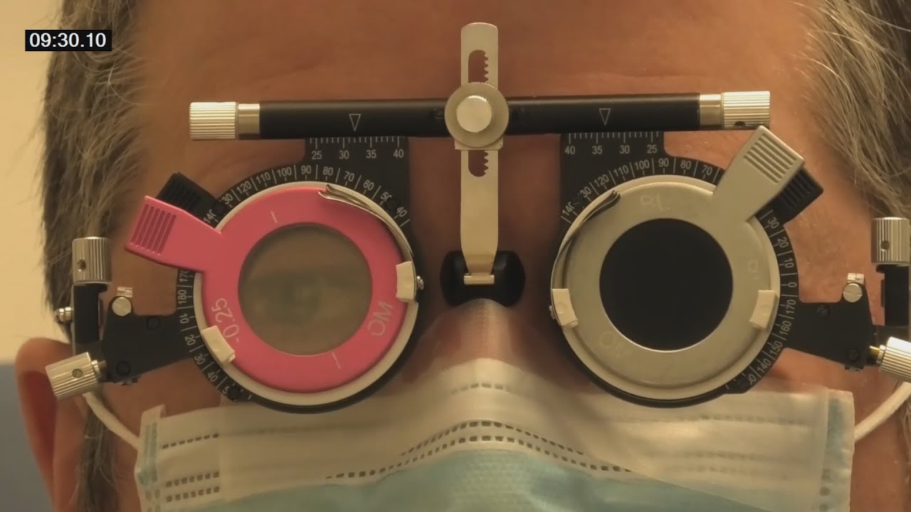 Refraction Coaching with Trialframe(not phoropter) #2