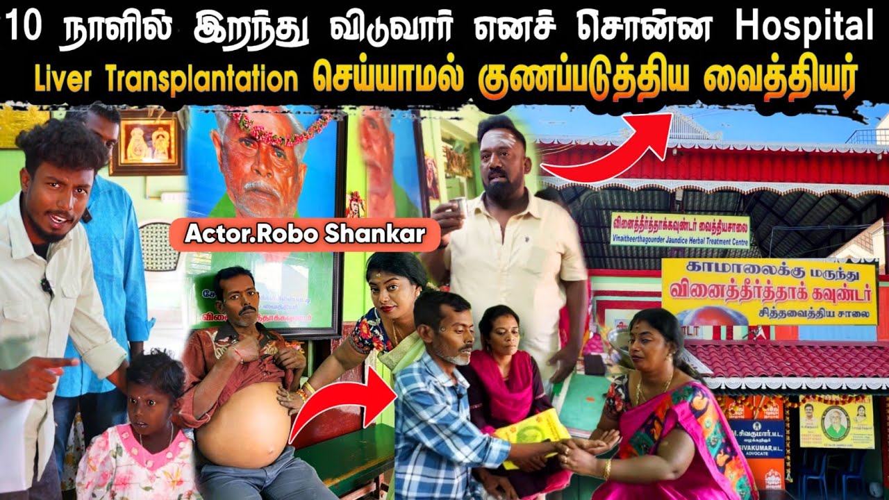 Actor Robo Shankar - ஐ குணப்படுத்திய வைத்தியர் | Vinai theertha Goundar Vaithiyasalai | Edison vlogs