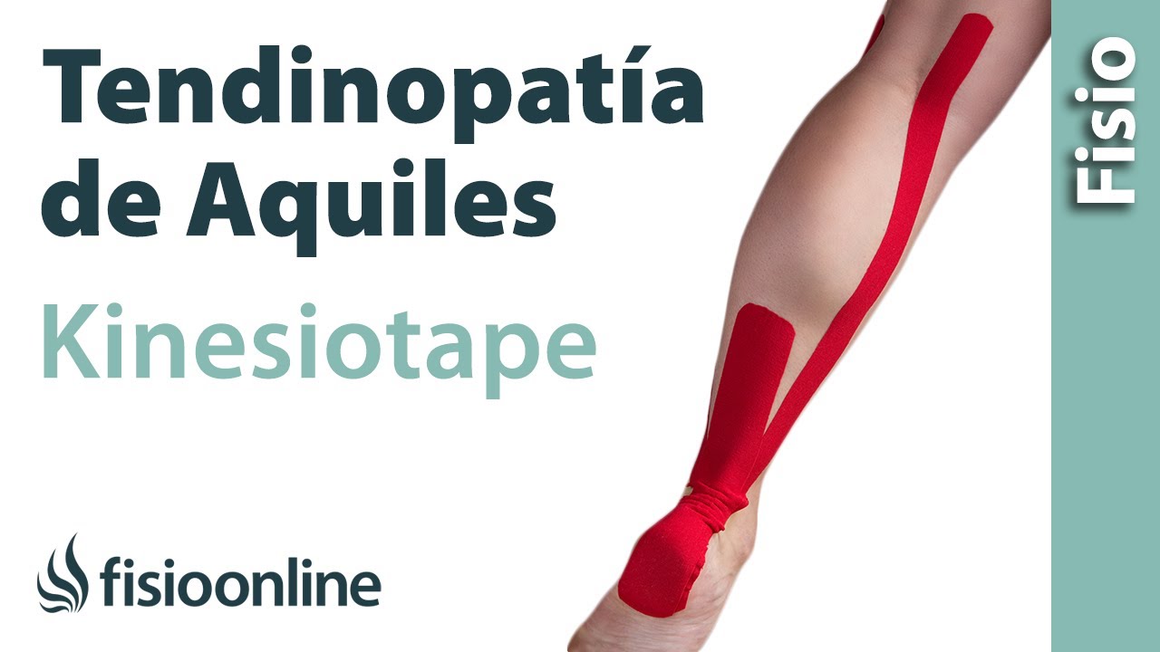 Aplicación de Kinesiostaping en la tendinopatia de Aquiles.