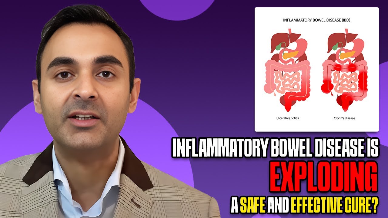 Inflammatory Bowel Disease is EXPLODING. A Safe and Effective CURE?
