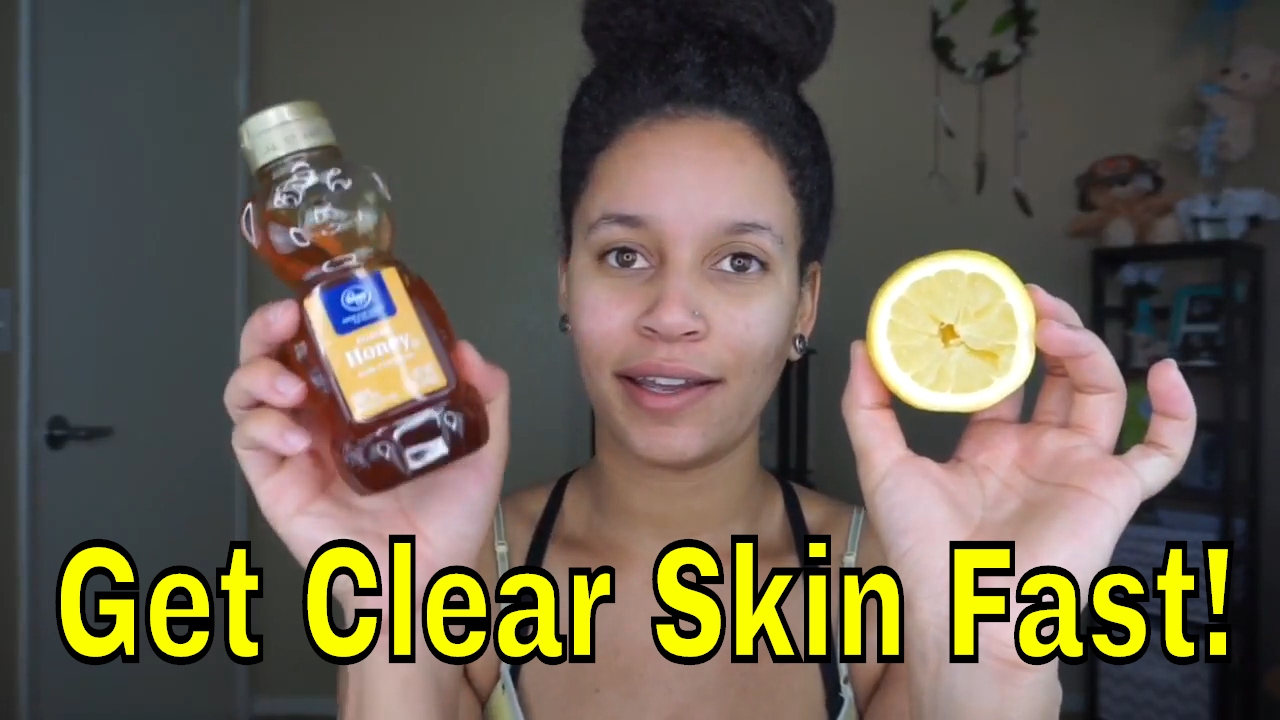 DIY Face Mask | Clear Skin With Honey & Lemon