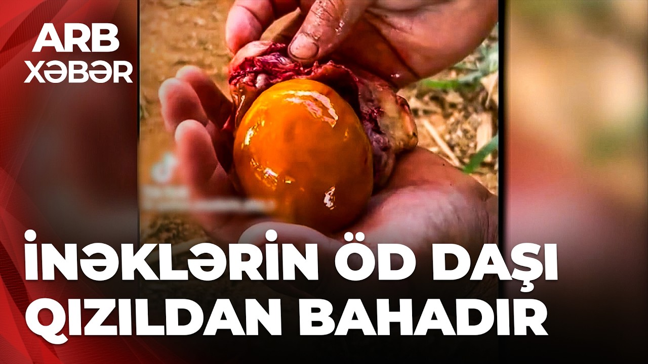 ARB XƏBƏR - İnəyin öd daşı 100 min manata satılır - Süni yolla “zənginlik” xəstəliyi