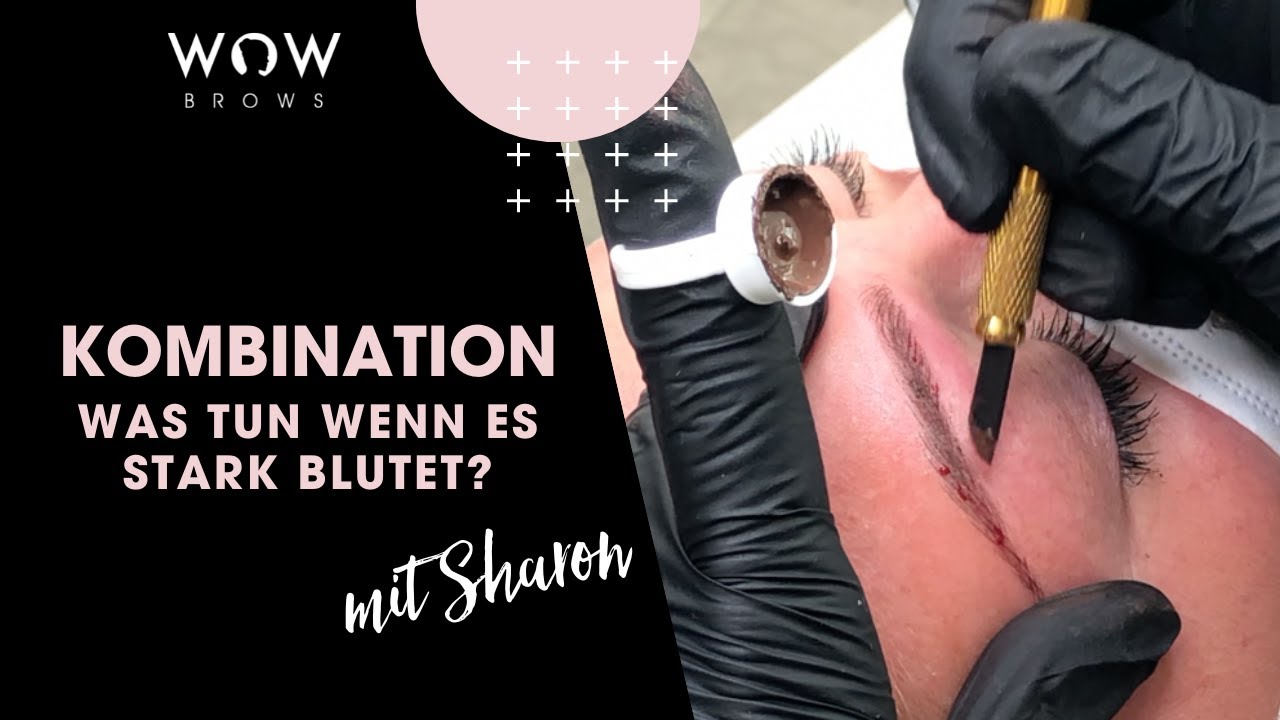 Wenn es stark blutet beim Pigmentieren