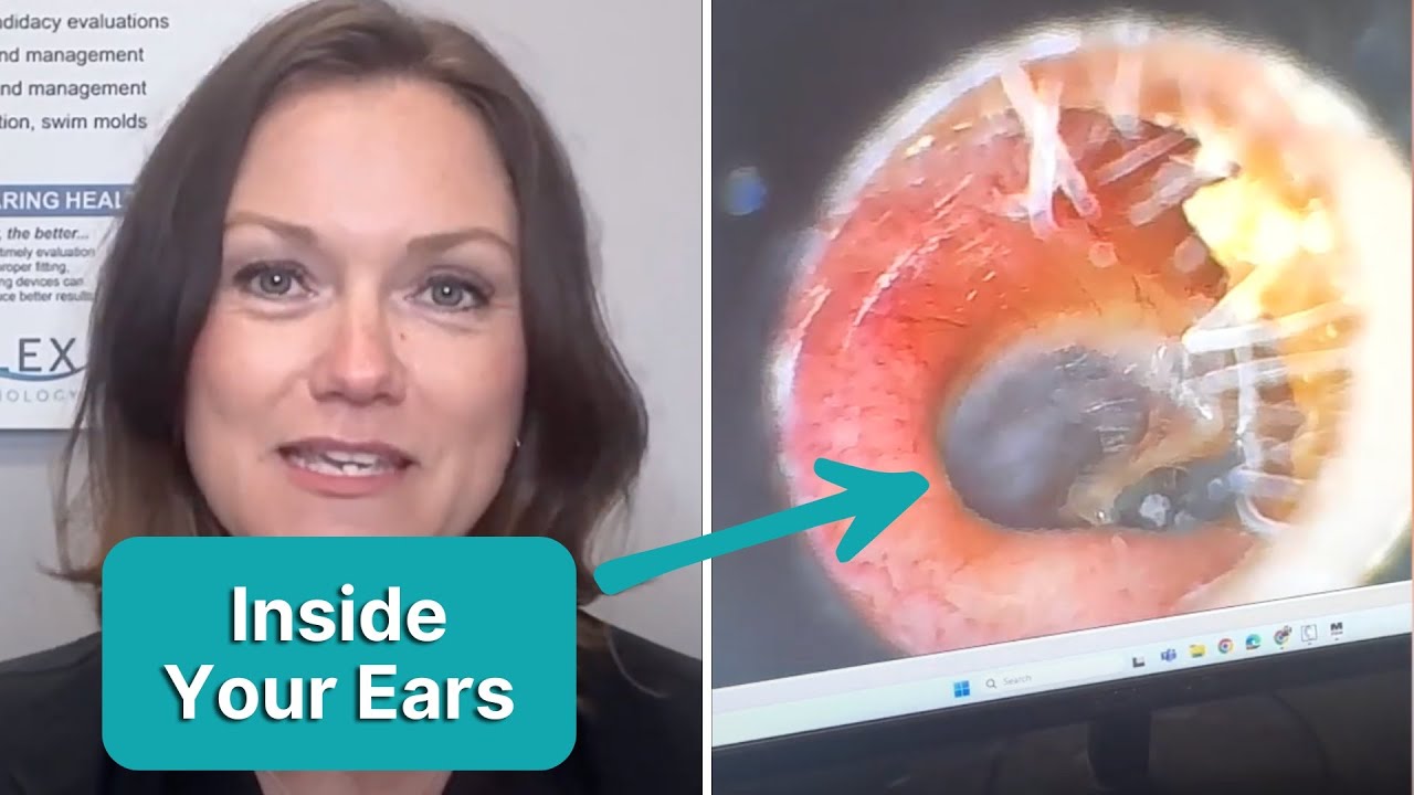 What Audiologists Look For Inside Your Ears | The Flex Audiology Show Ep. 33
