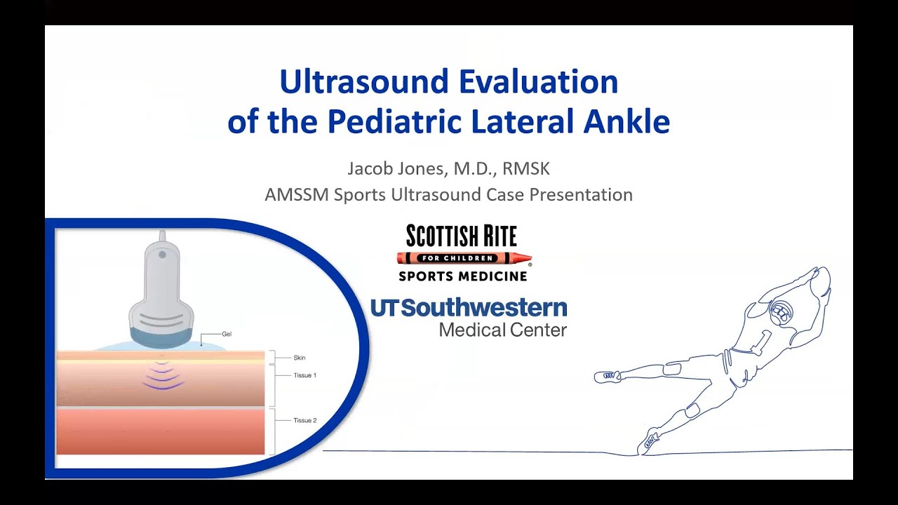Lateral Ankle Avulsion with Dr. Jacob Jones | AMSSM Sports Ultrasound Case Presentation