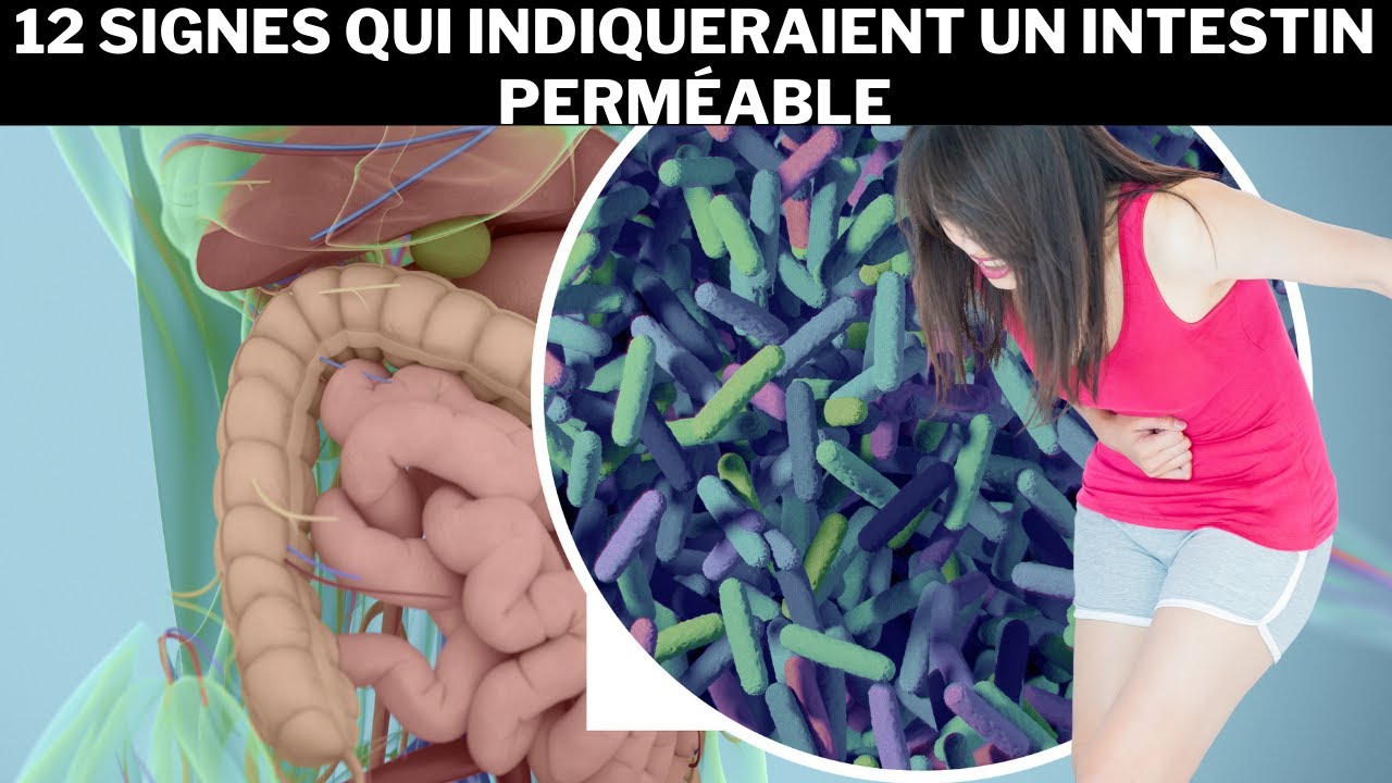 12 signes qui indiqueraient un intestin perm&eacute;able