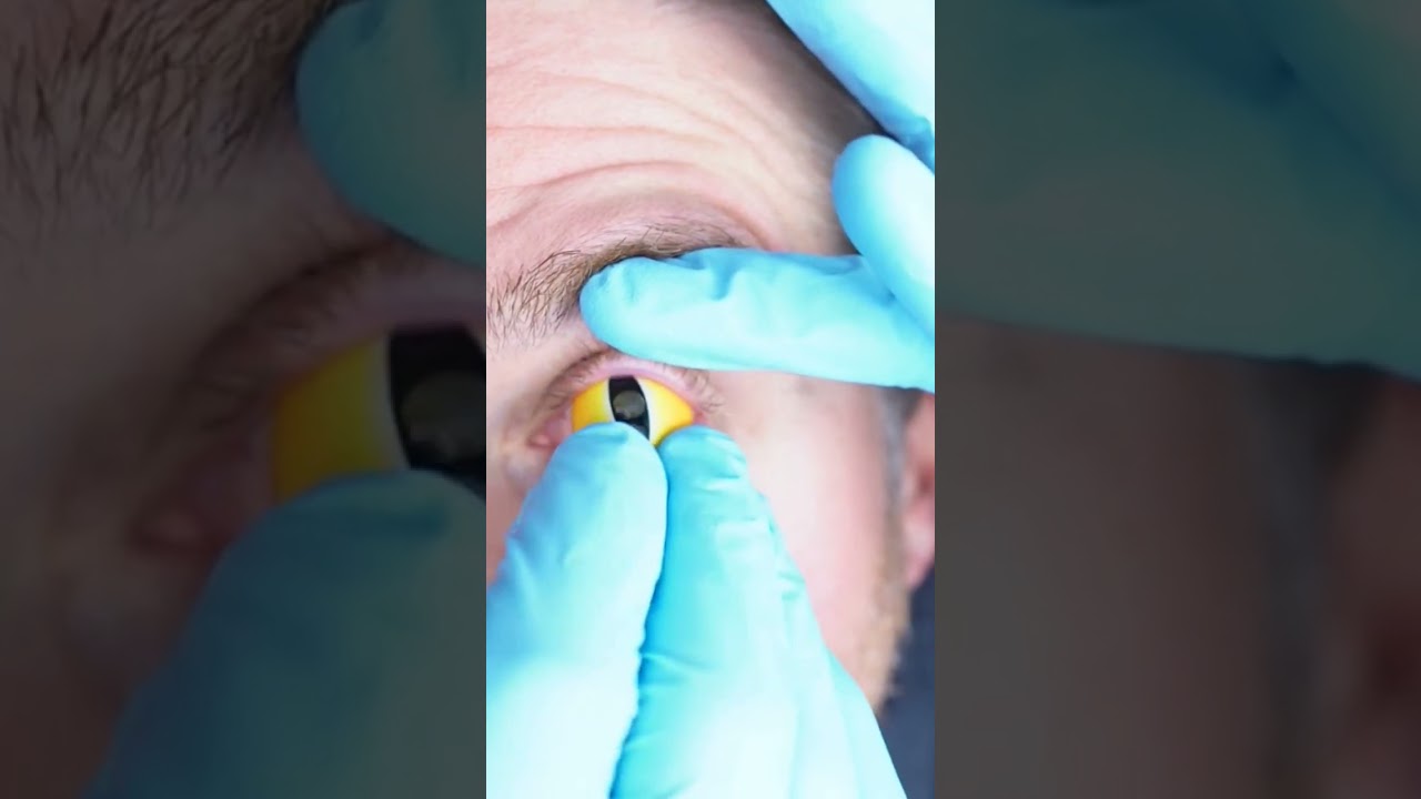 How To Put In Huge Sclera Halloween Contacts