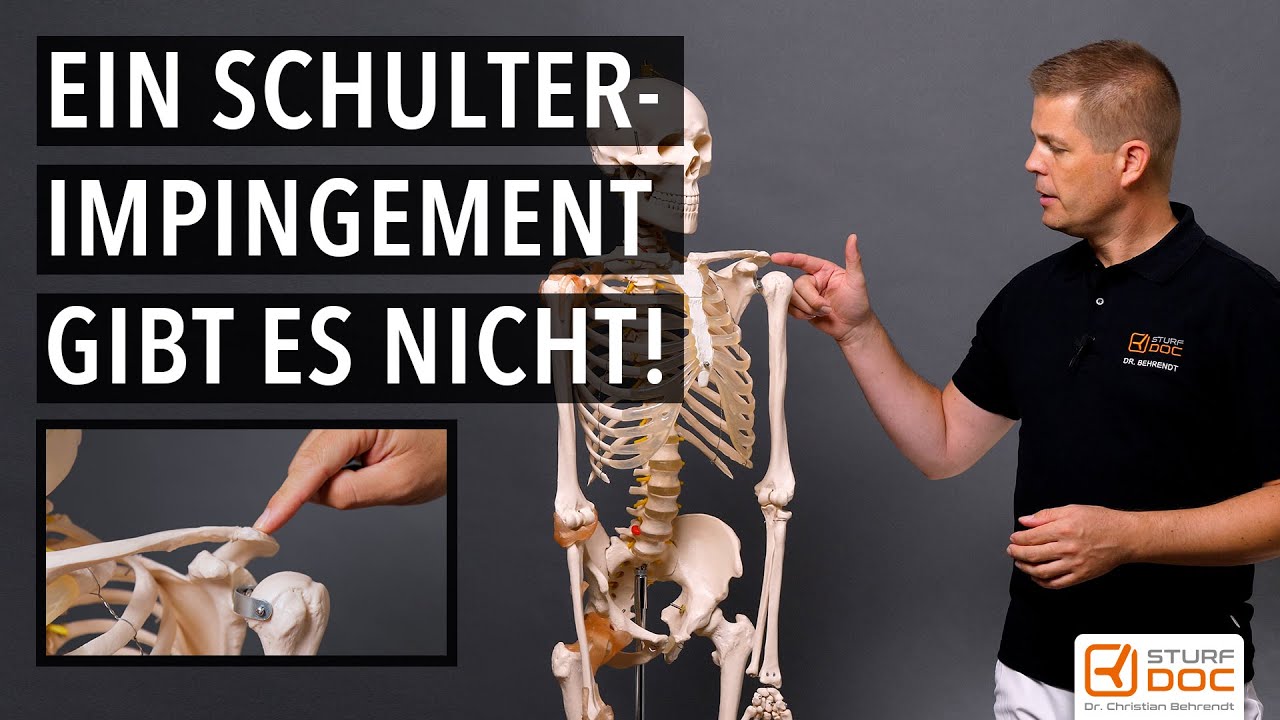 Das Impingementsyndrom der Schulter gibt es eigentlich nicht!