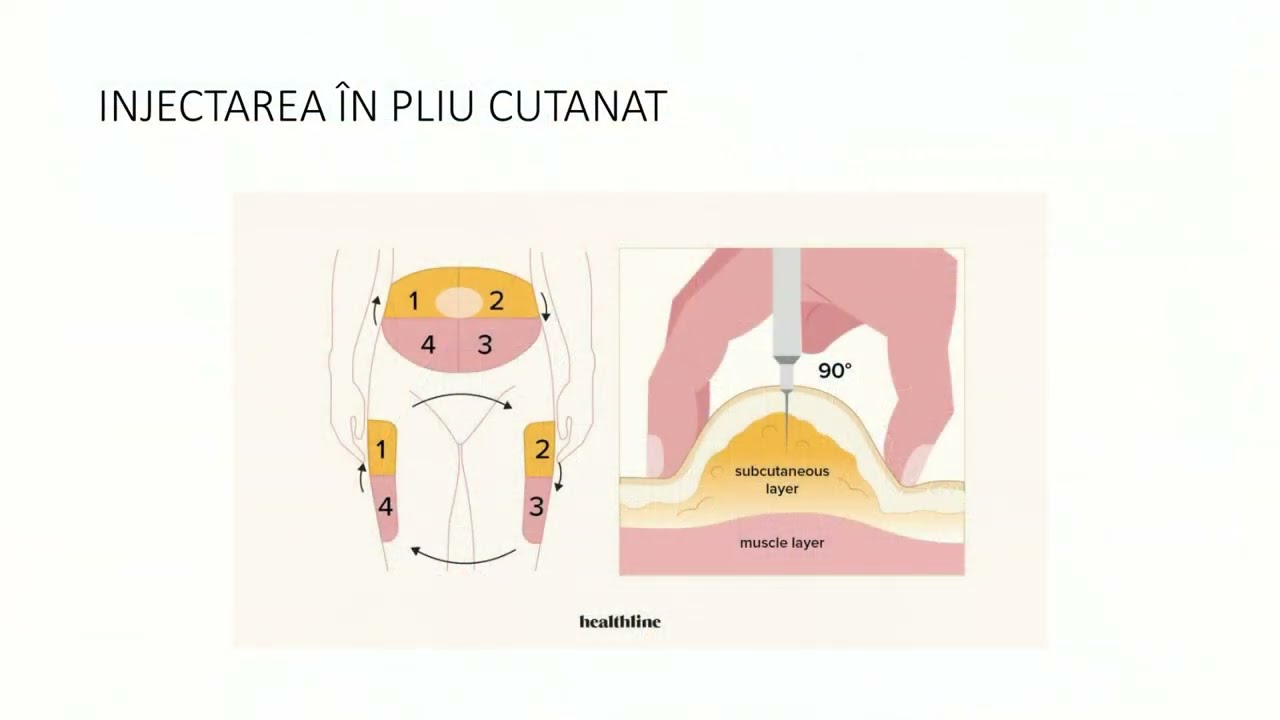 Tehnica injectării insulinei și consecințele administrării incorecte