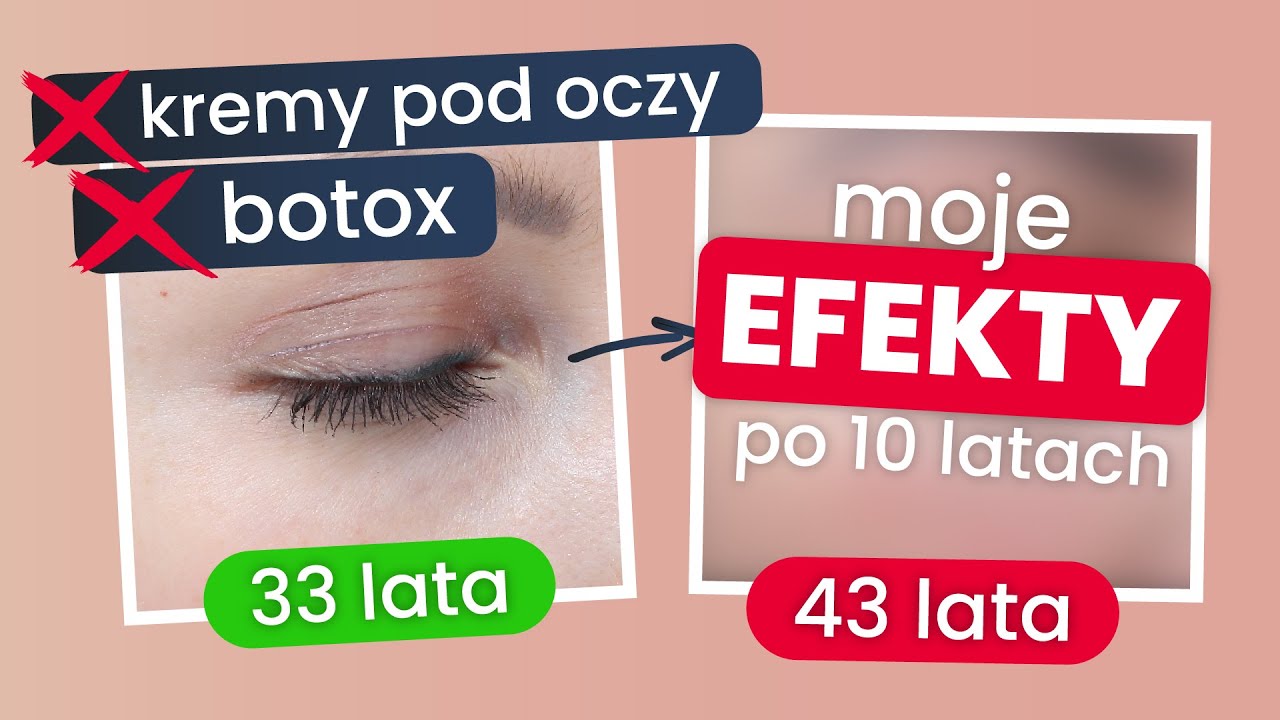 Oczy bez ZMARSZCZEK 👁️👁️ BEZ botoksu i innych zabiegów!