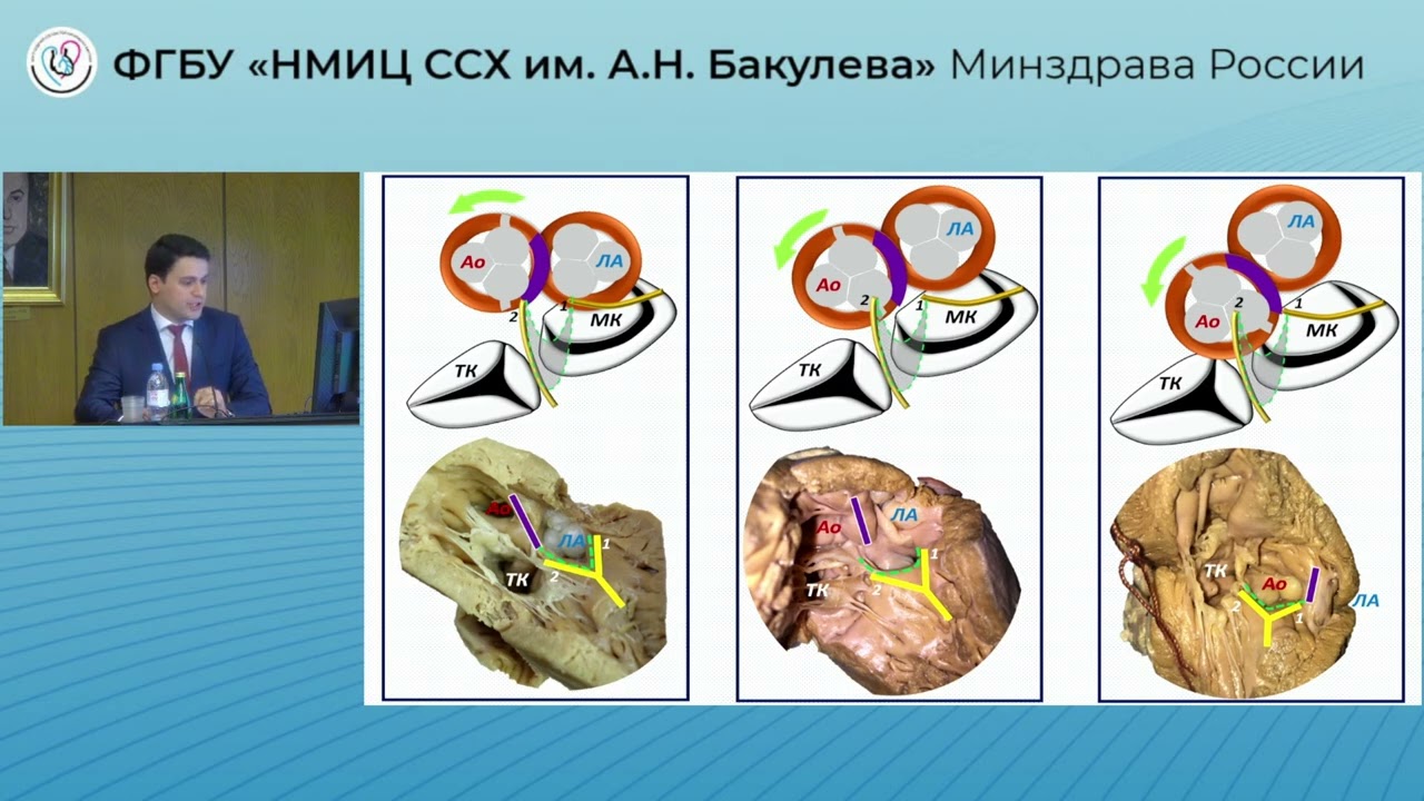Защита диссертации Джиджихия К. М.