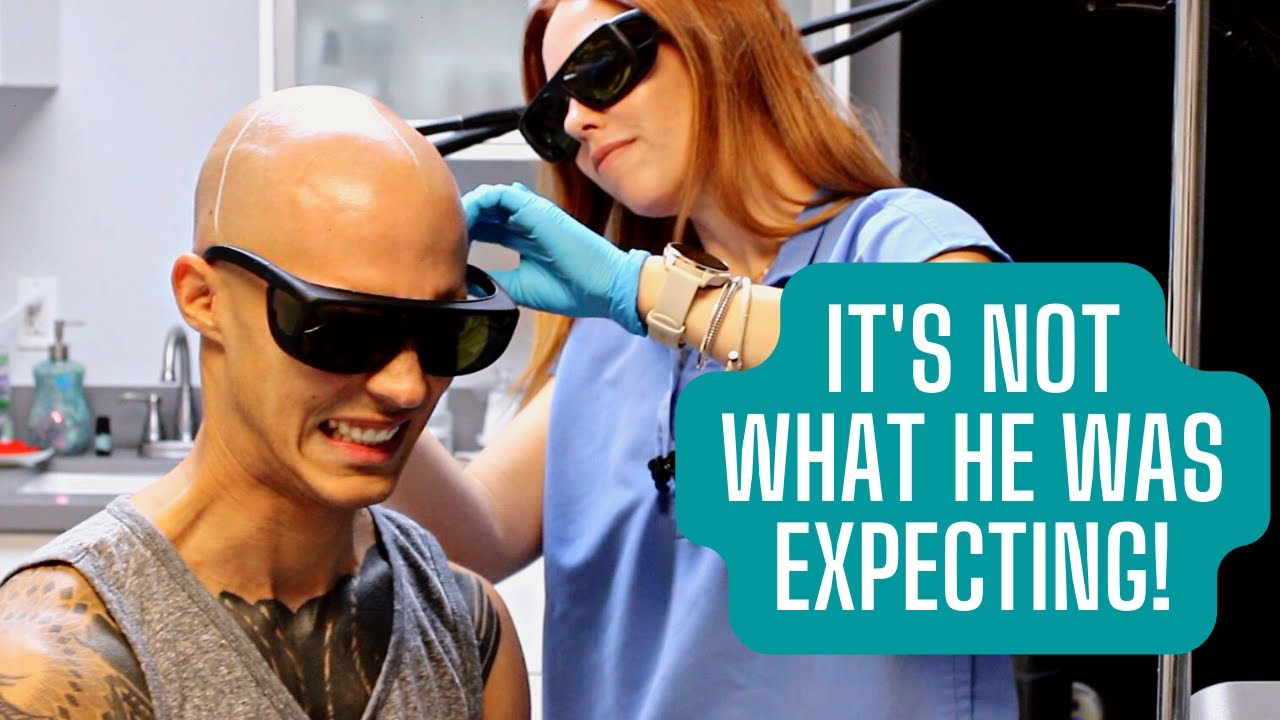 FIRST TIME SESSION | SCALP LASER HAIR REMOVAL