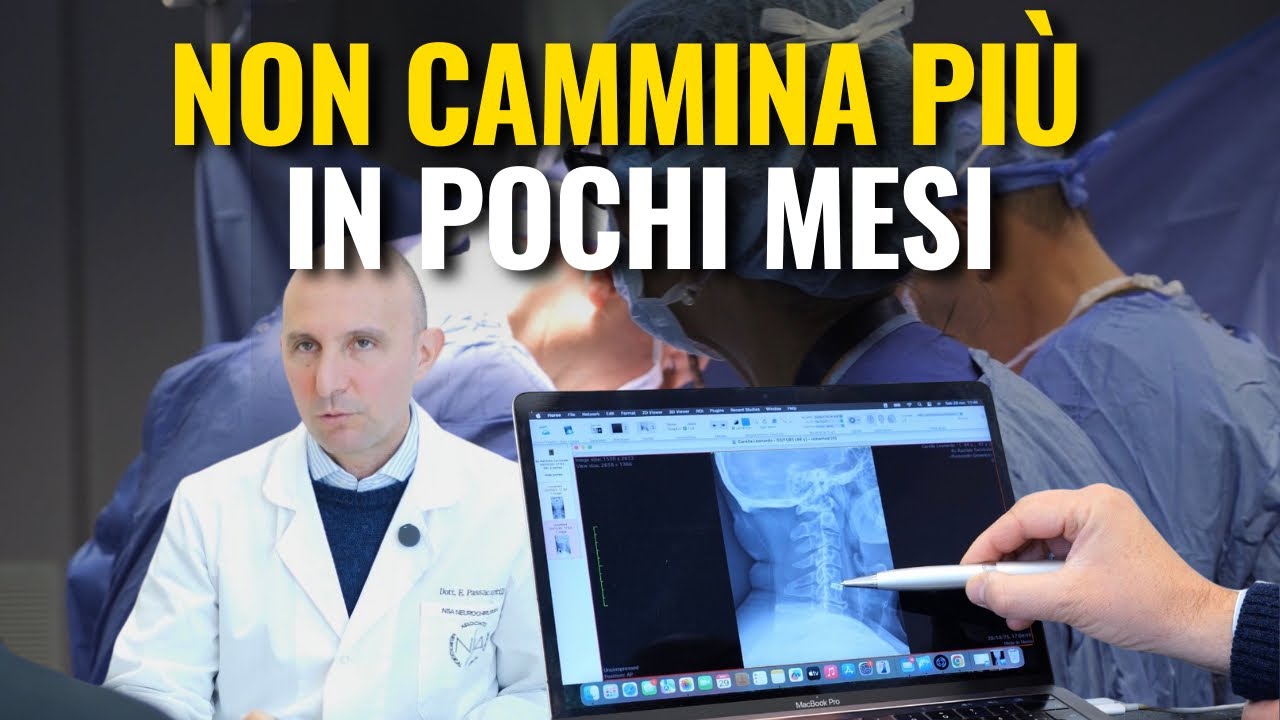 Neurochirurgia: Mielopatia cervicale severa a 44 anni | Dalla diagnosi al recupero 