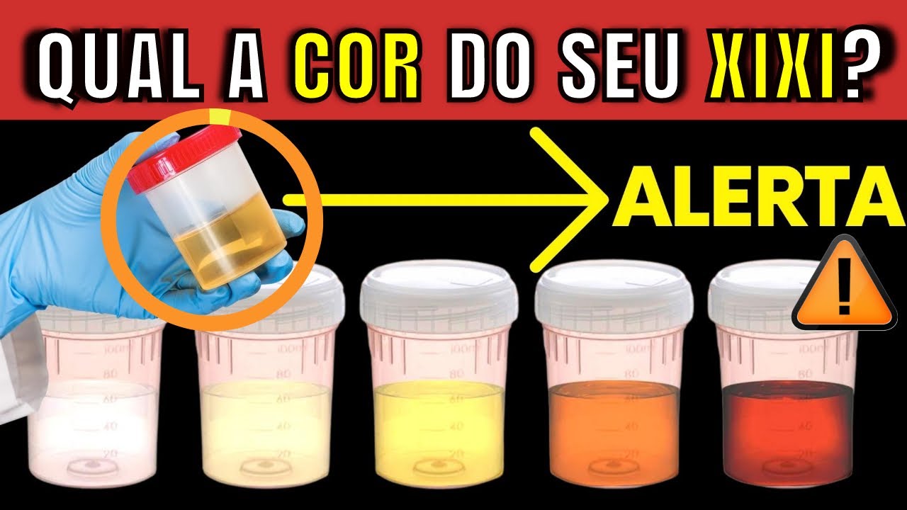 O que significa a COR da sua URINA? | Qual INDICA doença GRAVE? Quais os SINTOMAS ficar atento?