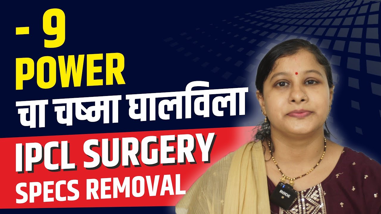 (Minus) -9 Power चा चष्मा घालविला || IPCL Surgery Specs Removal ||