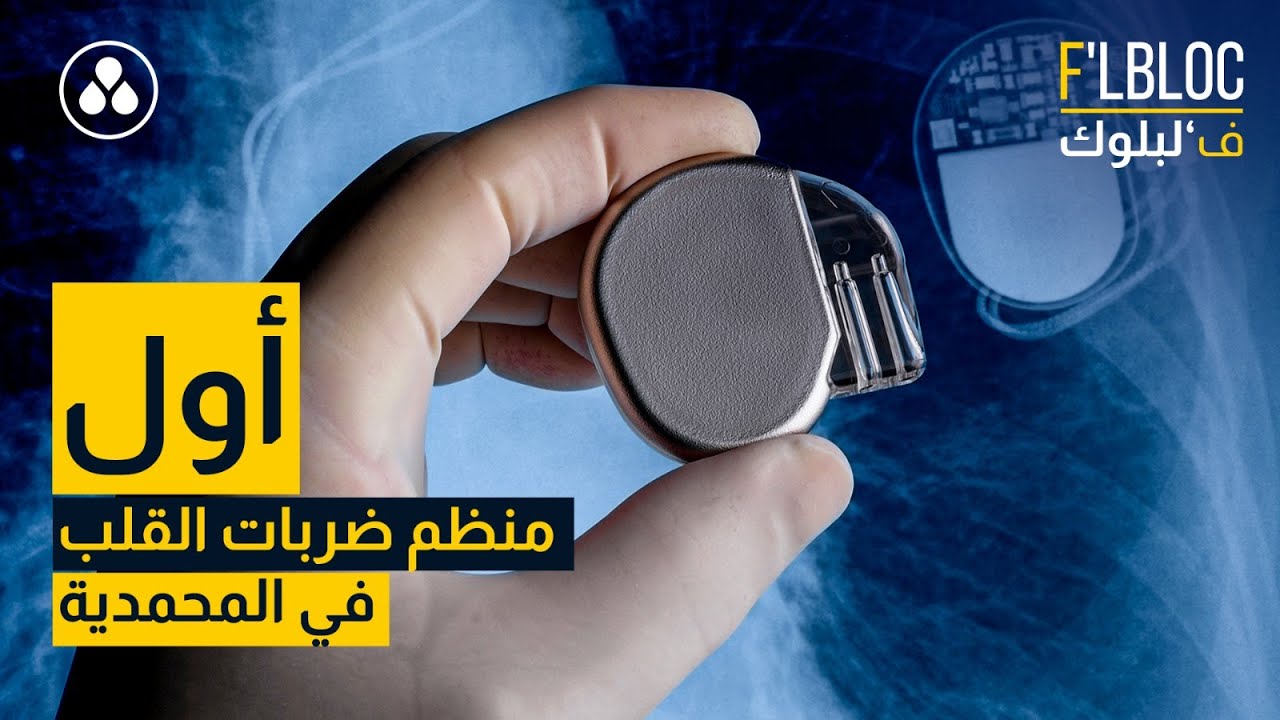 ف’لبلوك - أول عملية زرع منظم ضربات القلب في المحمدية