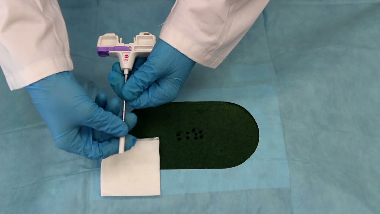PressTo Bone Marrow Biopsy Needle