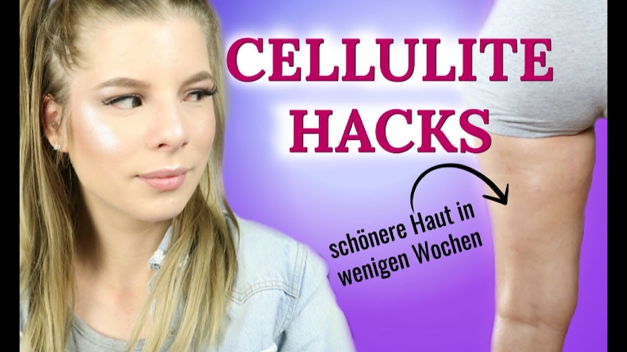 TIPPS gegen CELLULITE - DIE JEDES M&Auml;DCHEN KENNEN SOLLTE