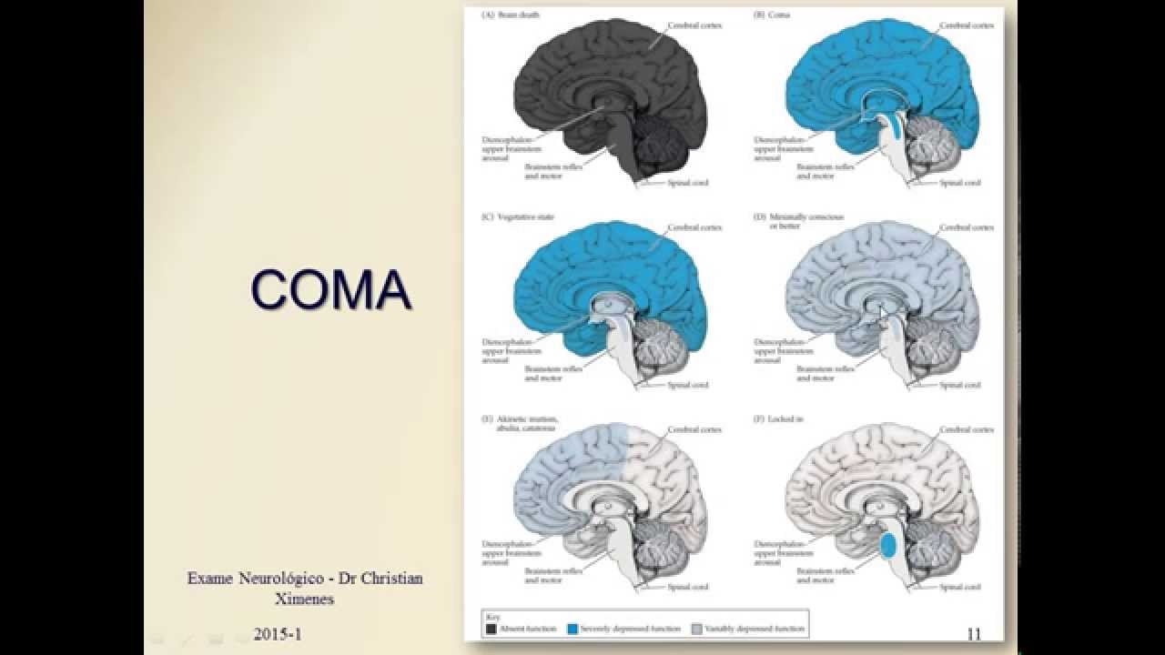 Semiologia Neurológica - Exame da Consciência